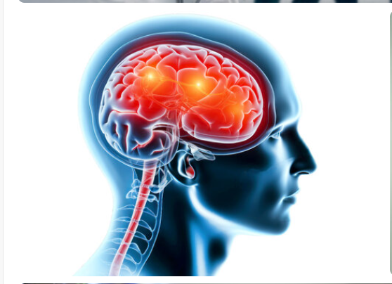 Best Headache, Stroke & Migraine Specialist In Vile Parle